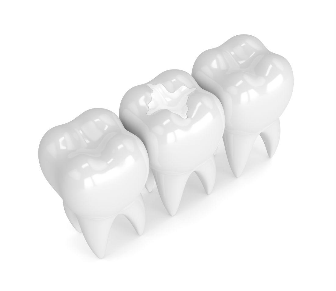 Sealants