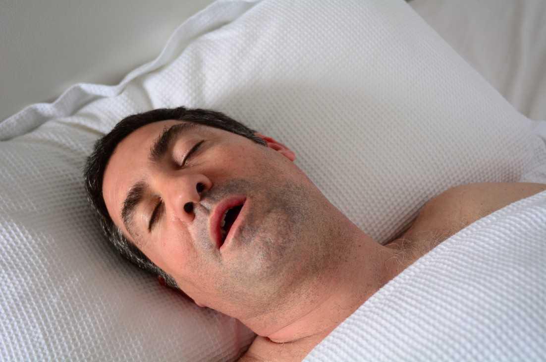 Sleep Apnea Treatment - Burke, Va